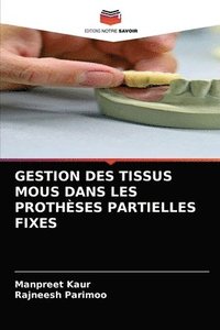 bokomslag Gestion Des Tissus MOUS Dans Les Prothses Partielles Fixes