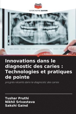 Innovations dans le diagnostic des caries: Technologies et pratiques de pointe 1