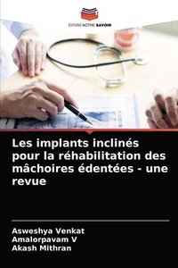 bokomslag Les implants inclins pour la rhabilitation des mchoires dentes - une revue