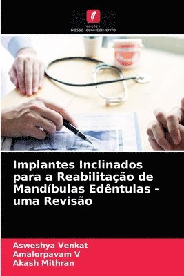 bokomslag Implantes Inclinados para a Reabilitao de Mandbulas Edntulas - uma Reviso