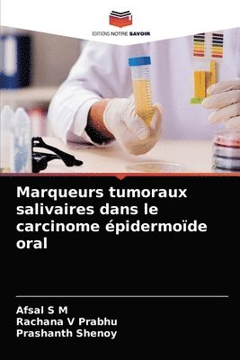 Marqueurs tumoraux salivaires dans le carcinome pidermode oral 1