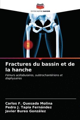 bokomslag Fractures du bassin et de la hanche