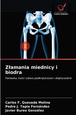 Zlamania miednicy i biodra 1