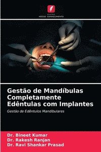 bokomslag Gestao de Mandibulas Completamente Edentulas com Implantes
