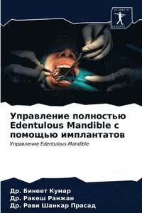 bokomslag &#1059;&#1087;&#1088;&#1072;&#1074;&#1083;&#1077;&#1085;&#1080;&#1077; &#1087;&#1086;&#1083;&#1085;&#1086;&#1089;&#1090;&#1100;&#1102; Edentulous Mandible &#1089;