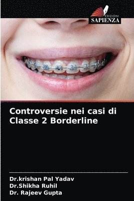 bokomslag Controversie nei casi di Classe 2 Borderline