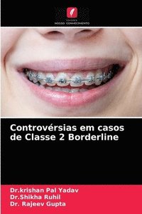 bokomslag Controversias em casos de Classe 2 Borderline