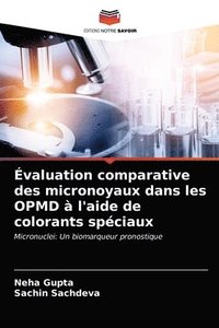 bokomslag Evaluation comparative des micronoyaux dans les OPMD a l'aide de colorants speciaux