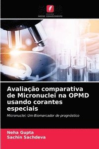 bokomslag Avaliacao comparativa de Micronuclei na OPMD usando corantes especiais