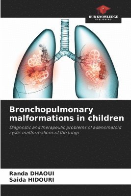 bokomslag Bronchopulmonary malformations in children