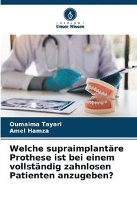 bokomslag Welche supraimplantäre Prothese ist bei einem vollständig zahnlosen Patienten anzugeben?