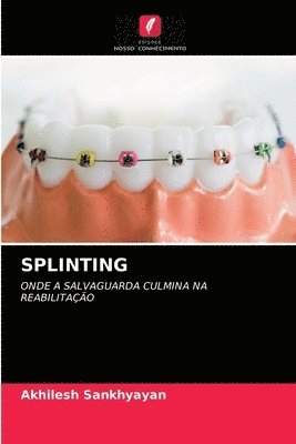 bokomslag Splinting