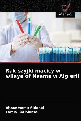 bokomslag Rak szyjki macicy w wilaya of Naama w Algierii