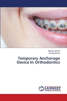 bokomslag Temporary Anchorage Device In Orthodontics