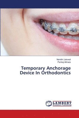 Nandini Jaiswal, Pankaj Akhare - Temporary Anchorage Device In Orthodontics, Häftad