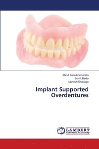bokomslag Implant Supported Overdentures