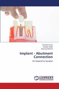 bokomslag Implant - Abutment Connection