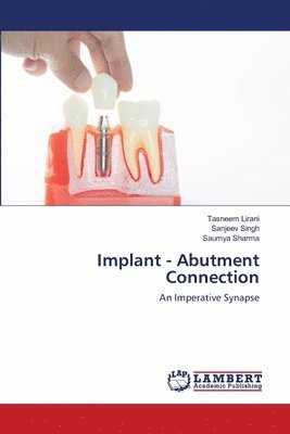 Implant - Abutment Connection 1