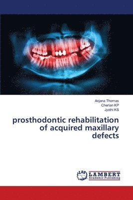 prosthodontic rehabilitation of acquired maxillary defects 1