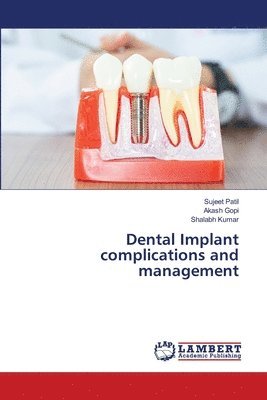 bokomslag Dental Implant complications and management