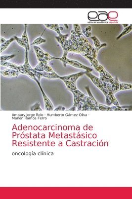 bokomslag Adenocarcinoma de Prstata Metastsico Resistente a Castracin