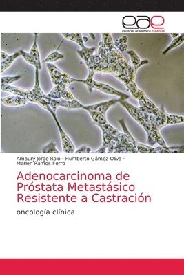 Adenocarcinoma de Prstata Metastsico Resistente a Castracin 1
