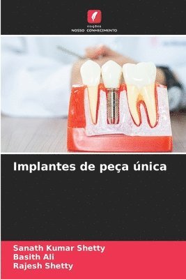 Implantes de peça única