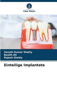 bokomslag Einteilige Implantate