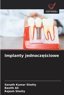 Implanty jednoczęściowe