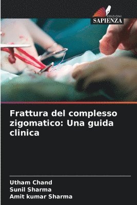Utham Chand, Sunil Sharma, Amit Kumar Sharma - Frattura del complesso zigomatico, Häftad