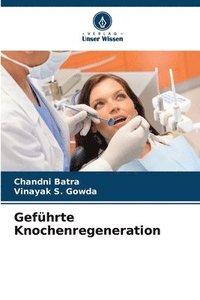 bokomslag Geführte Knochenregeneration