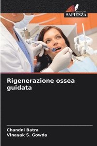 bokomslag Rigenerazione ossea guidata