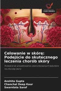 bokomslag Celowanie w skór?: Podej?cie do skutecznego leczenia chorób skóry