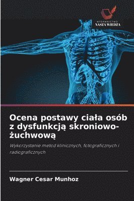 Wagner Cesar Munhoz - Ocena postawy ciala osób z dysfunkcją skroniowo-żuchwową, Häftad