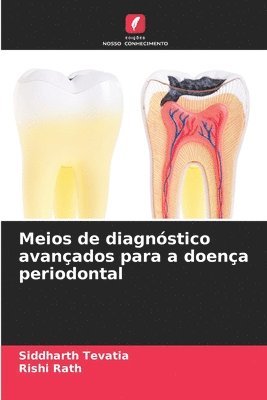 bokomslag Meios de diagnóstico avançados para a doença periodontal