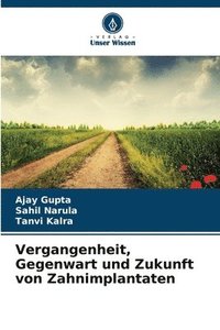 bokomslag Vergangenheit, Gegenwart und Zukunft von Zahnimplantaten