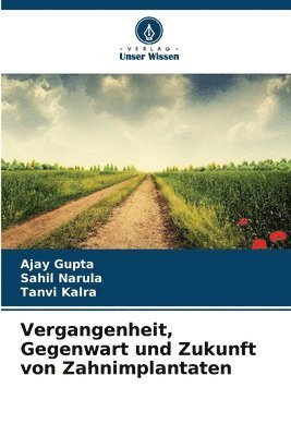 Ajay Gupta, Sahil Narula, Tanvi Kalra - Vergangenheit, Gegenwart und Zukunft von Zahnimplantaten, Häftad
