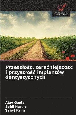 Przeszlośc, teraźniejszośc i przyszlośc implantów dentystycznych