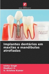 bokomslag Implantes dentários em maxilas e mandíbulas atrofiadas