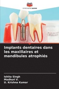 bokomslag Implants dentaires dans les maxillaires et mandibules atrophiés