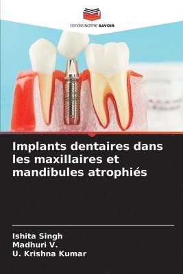 bokomslag Implants dentaires dans les maxillaires et mandibules atrophiés