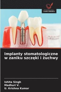 bokomslag Implanty stomatologiczne w zaniku szcz?ki i ?uchwy