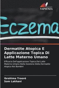 bokomslag Dermatite Atopica E Applicazione Topica Di Latte Materno Umano
