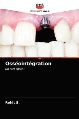 Ossointgration 1