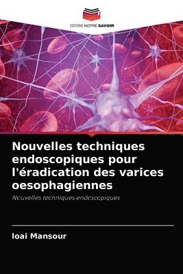 Nouvelles techniques endoscopiques pour l'radication des varices oesophagiennes 1