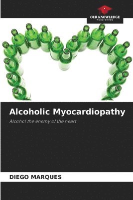 Alcoholic Myocardiopathy 1