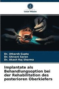 bokomslag Implantate als Behandlungsoption bei der Rehabilitation des posterioren Oberkiefers