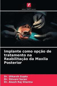 bokomslag Implante como opo de tratamento na Reabilitao da Maxila Posterior