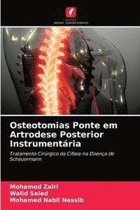 bokomslag Osteotomias Ponte em Artrodese Posterior Instrumentria