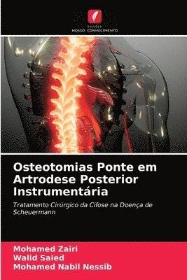 bokomslag Osteotomias Ponte em Artrodese Posterior Instrumentria